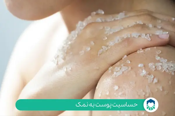 حساسیت پوست به نمک | ایران طب مگ