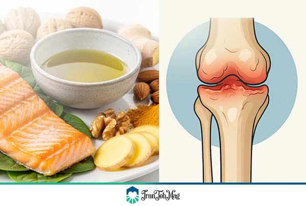 درمان خانگی آرتروز زانو | ایران طب مگ