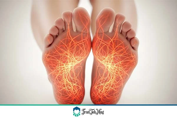 داغی کف پا | ایران طب مگ