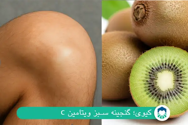 کیوی؛ گنجینه سبز ویتامین C