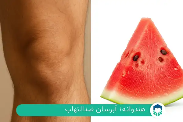 هندوانه؛ آبرسان ضدالتهاب | ایران طب مگ