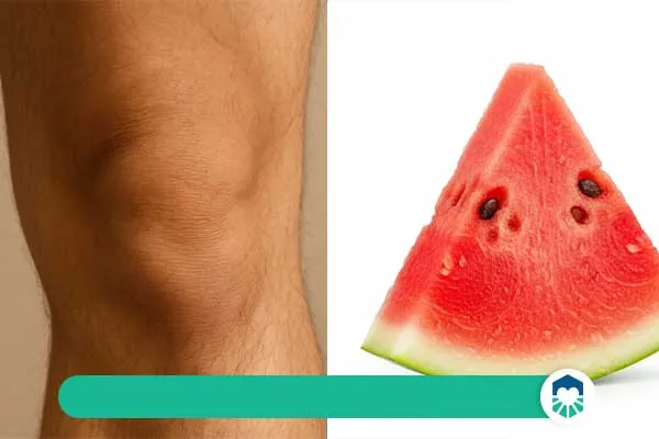هندوانه؛ آبرسان ضدالتهاب برای زانو درد | ایران طب مگ