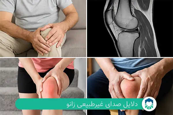 دلایل صدای غیرطبیعی زانو| ایران طب مگ