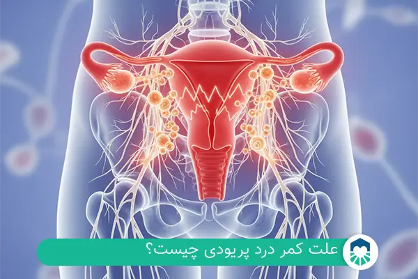 کمر درد پریودی چیست | ایران طب مگ