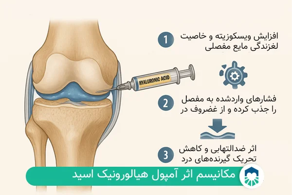مکانیسم اثر آمپول هیالورونیک اسید | ایران طب مگ
