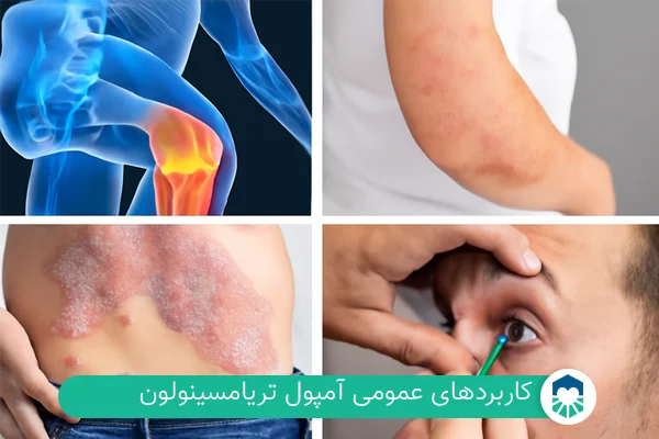 کاربرد های آمپول تریامسینولون | ایران طب مگ