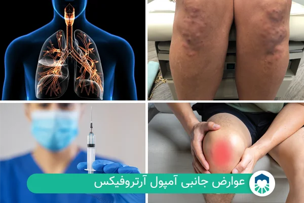 عوارض جانبی آمپول آرتروفیکس | ایران طب مگ
