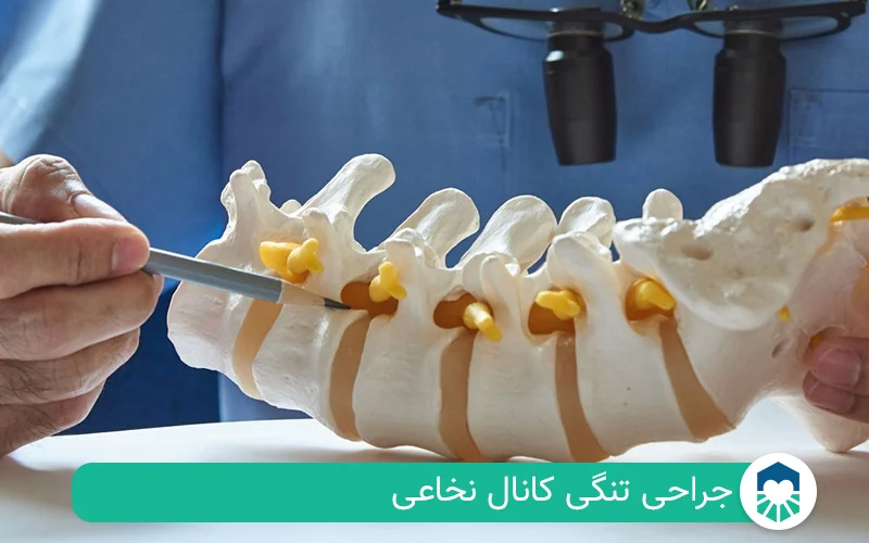 جراحی تنگی کانال نخاعی | ایران طب مگ