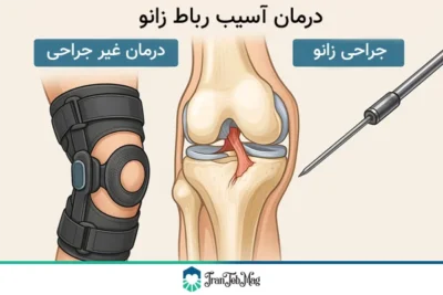 جراحی آسیب رباط زانو | ایران طب مگ