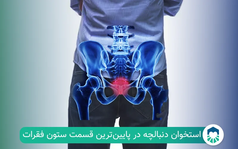 دنبالچه کجاست؟ | ایران طب مگ