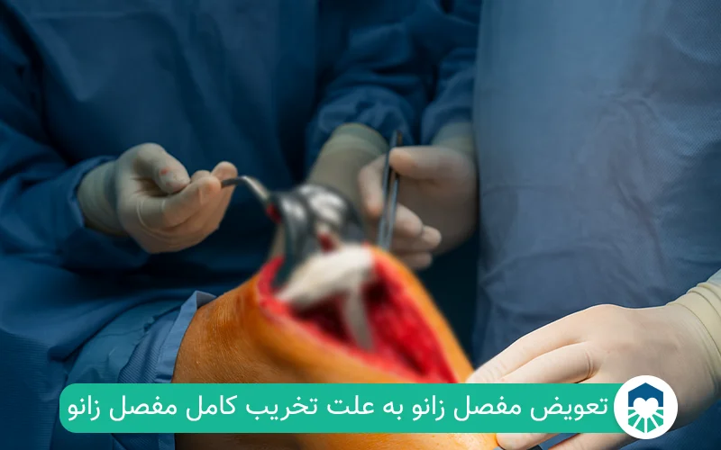جراحی تعویض مفصل زانو | ایران طب مگ