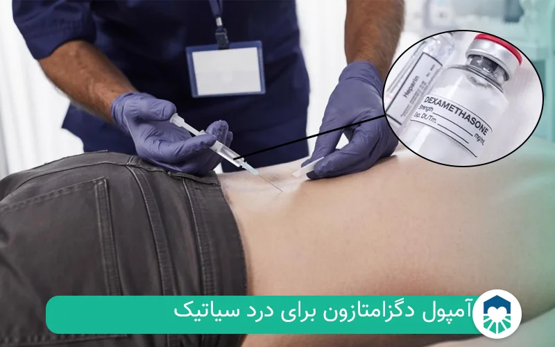 آمپول دگزامتازون برای درد سیاتیک | ایران طب مگ