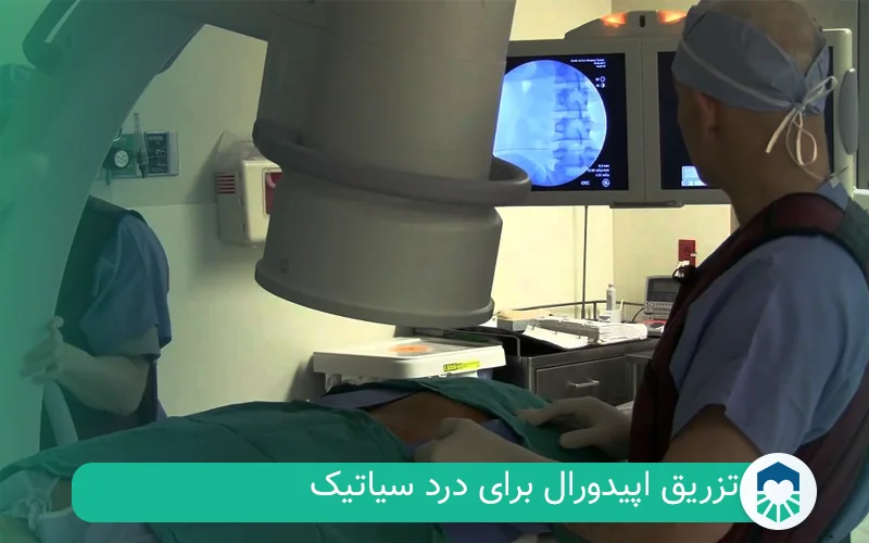 تزریق اپیدورال برای درد سیاتیک | ایران طب مگ