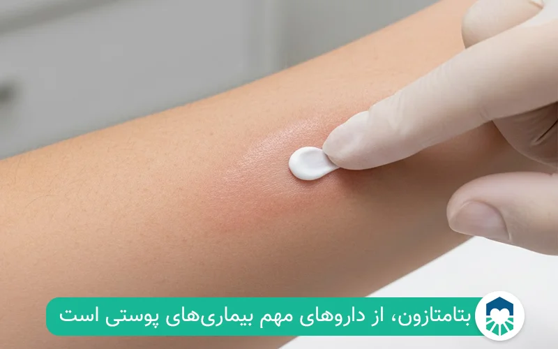 پماد بتامتازون برای پوست | ایران طب مگ